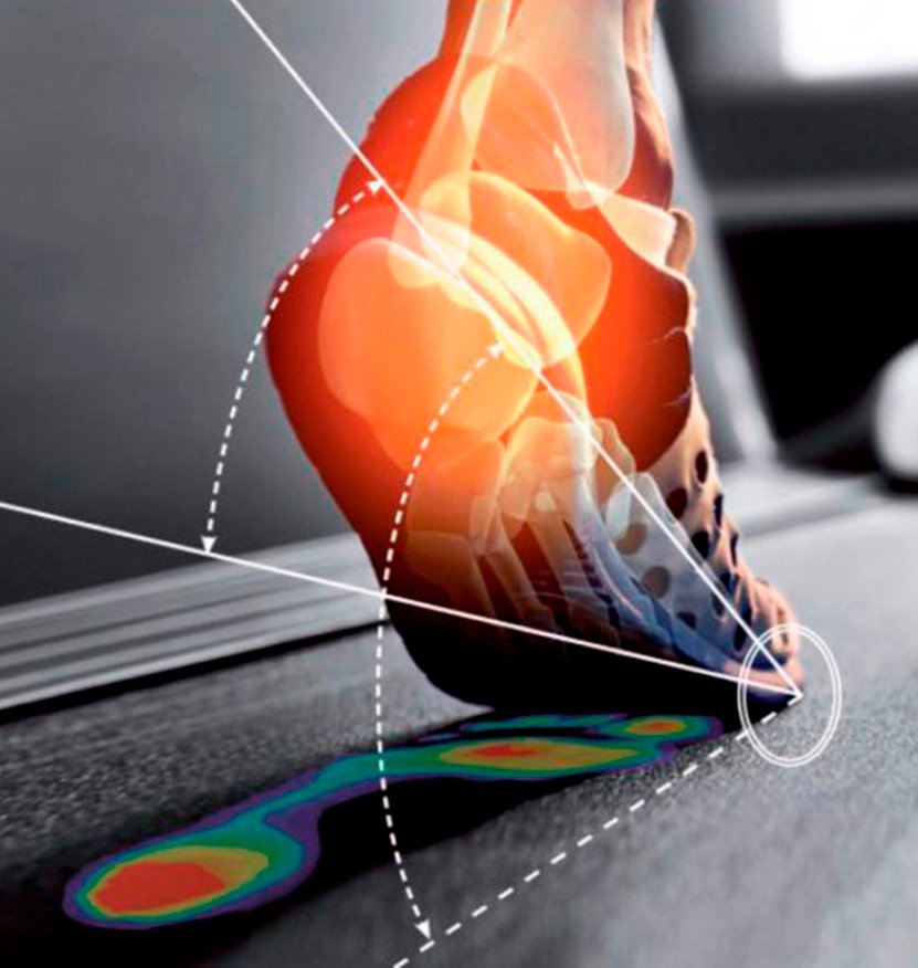 Estuduio de la pisada Sant adria del besos