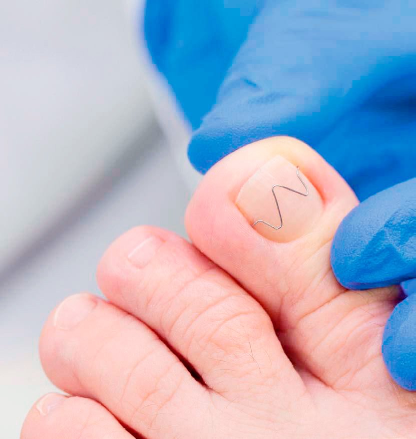 Ortonixia Sant adria del besos